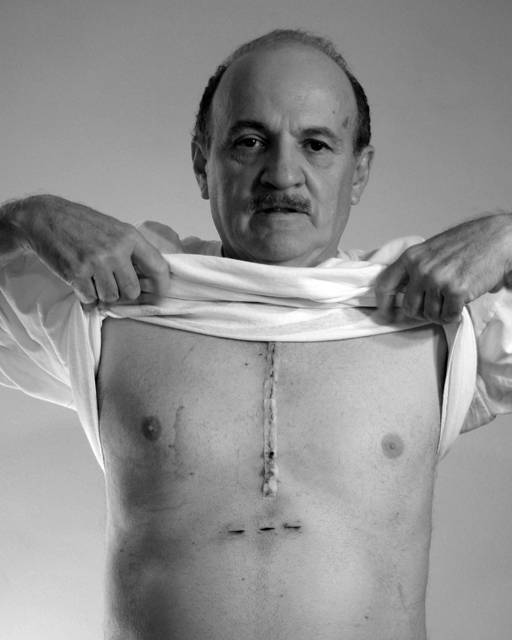 Portrait of a man showing a scar